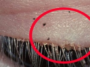 ENFEKSİYON ZANNETTİ BAKIN NE ÇIKTI! BU KADARIDA OLMAZ DEMEYİN...