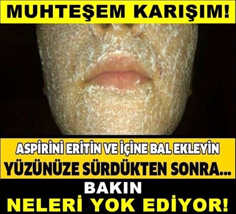 Aspirin Maskesi Uygulanması ve Yapımı galerisi resim 1