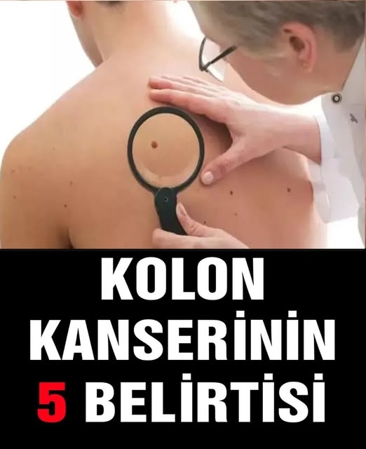 Son yıllarda artan vakalarla birlikte uzmanların sık sık uyardığı galerisi resim 1