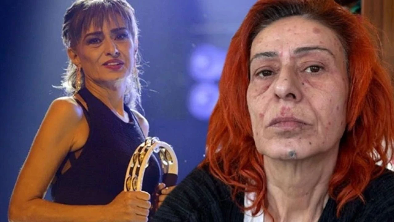 YILDIZ TİLBE galerisi resim 1