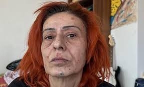 YILDIZ TİLBE galerisi resim 2