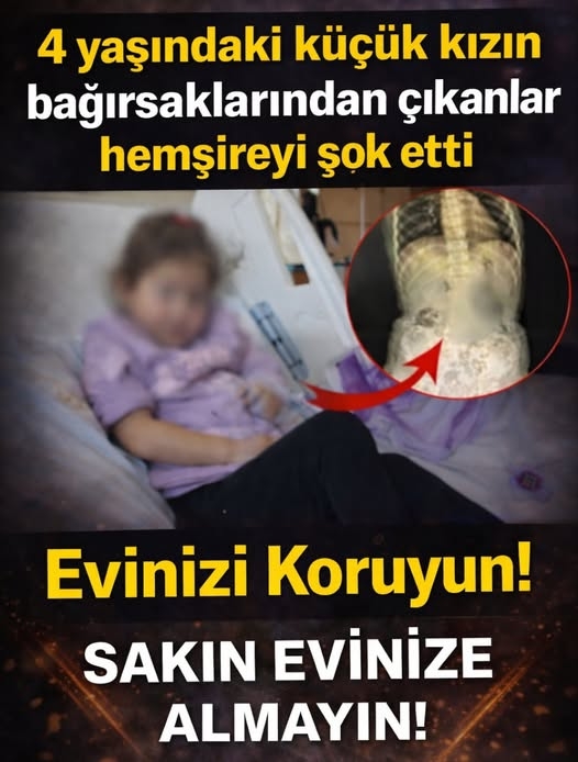 4 Yaşındaki Küçük Kızın bağırsağın dan çıkanlar şaşkına Çevirdi.. galerisi resim 3