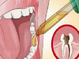 Diş ağrısından duramıyorsanız bunu mutlaka deneyin