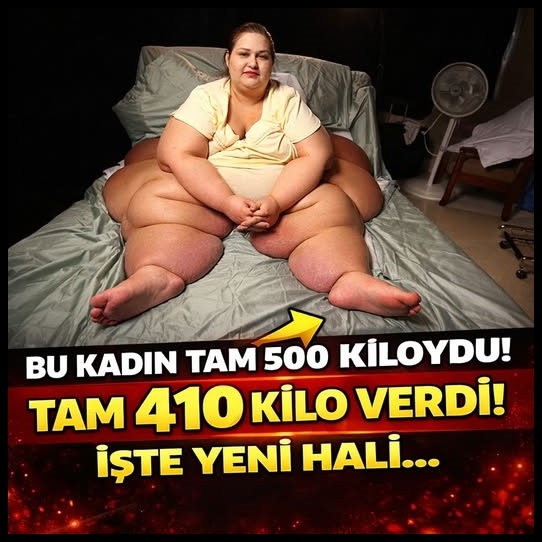 Yarım tonluk dünyanın en obez kadınıydı! galerisi resim 2