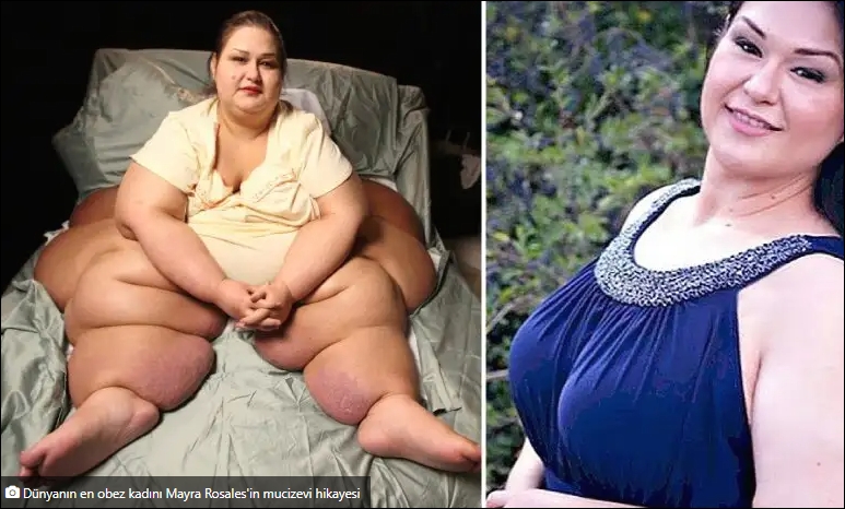 Yarım tonluk dünyanın en obez kadınıydı! galerisi resim 5