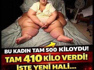 Yarım tonluk dünyanın en obez kadınıydı!