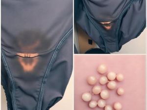 Çamaşırınızda Bunu Görürseniz