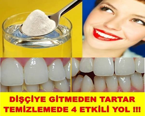 Dişçiye Gitmeden Tartar Temizlemede En Etkili 4 Yol.. galerisi resim 1