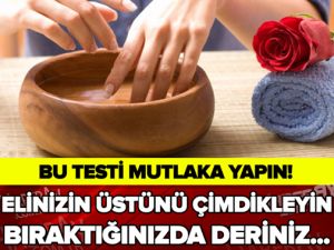 ELİNİZİN ÜSTÜNÜ ÇİMDİKLEYİN BIRAKTIĞINIZDA DERİNİZ...