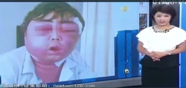 Onu bu hale getiren şeye inanamayacaksınız! galerisi resim 2