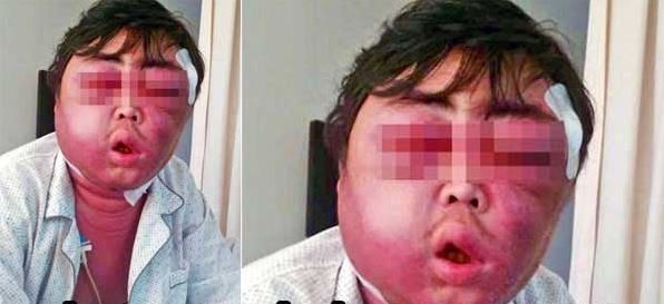 Onu bu hale getiren şeye inanamayacaksınız! galerisi resim 3