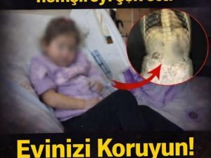 4 YAŞINDAKİ KIZIN KARNINDA