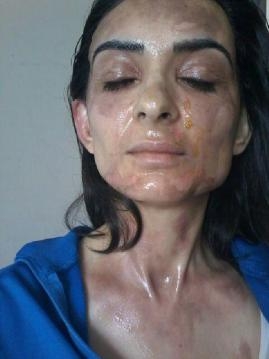 O AN ÇIĞLIK ÇIĞLIĞA KALDI! galerisi resim 4