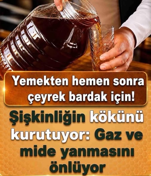 Yemeklerden sonra mideniz galerisi resim 1