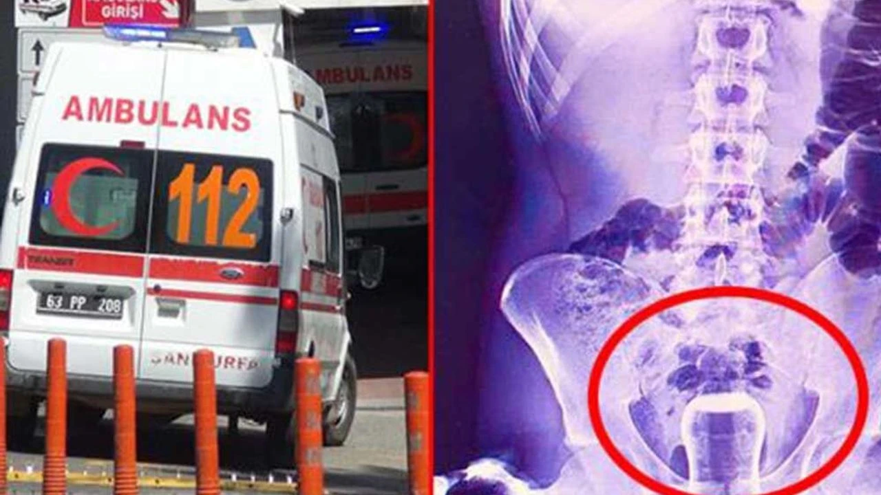 Şanlıurfa’da tedavi için hacamat yaptıran adam galerisi resim 2