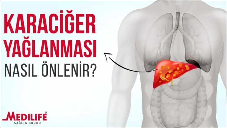 Canan Karatay K'anseri Ve Alzheimer Önleyici Besin galerisi resim 3