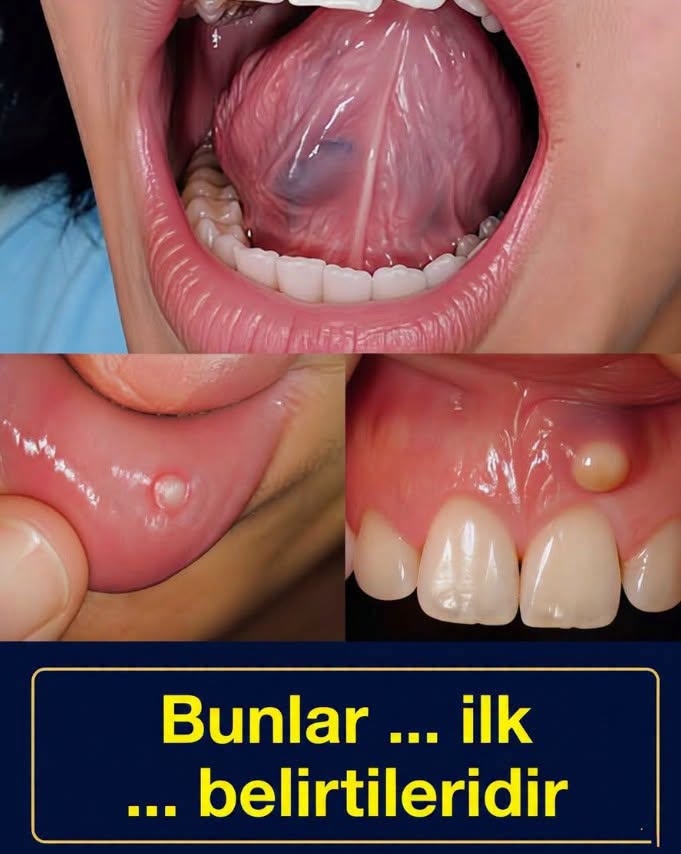 Bunlar bir hastalığın ilk belirtileridir galerisi resim 1