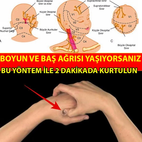 Baş ve Boyun Ağrısı Olanlar Dikkat galerisi resim 1