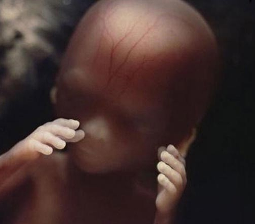 Çocuk Aldırmanın Cinayet Olduğunu Bu Hikaye Çok Güzel Özetlemiş galerisi resim 5