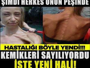 SON HALİNİ GÖRENLER İNANAMIYOR! BAKIN ŞİMDİ NE HALDE...