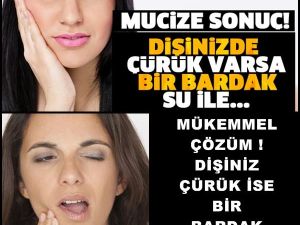MÜKEMMEL ÇÖZÜM ! DİŞİNİZ ÇÜRÜK İSE BİR BARDAK SU İLE……