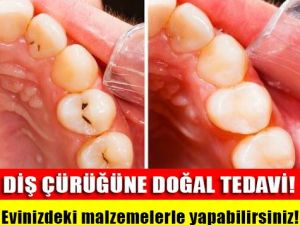 Dişteki çürük doğal yöntemle nasıl gider? İşte diş çürüğünü gidermenin y