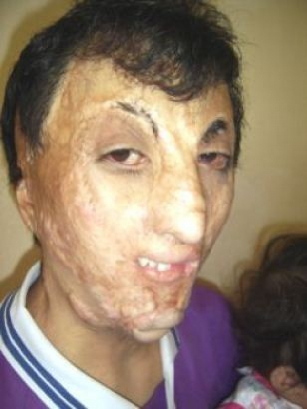 Kuran'a basan çocuk ne hale geldi galerisi resim 7