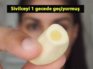 Sivilceyi 1 gecede geçiren yöntem