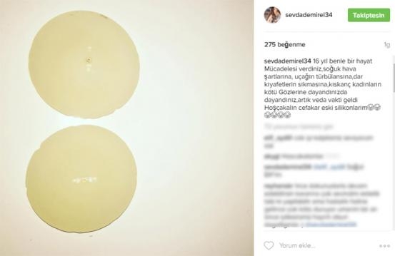 SEVDA DEMİREL TAKİPÇİLERİNİ ŞOK ETTİ! galerisi resim 3