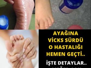 AYAĞINA VİCKS SÜRDÜ O HASTALIĞI HEMEN GEÇTİ.. İŞTE DETAYLAR.. MEĞER ÇOK 