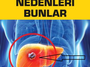 Neden kanser oluyoruz? Bu yazıyı mutlaka herkesle paylaşalım… hayatımıza