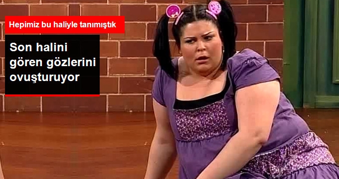 Son Halini Gören Tanıyamıyor Pelin Öztekin Gittikçe Eriyor galerisi resim 1