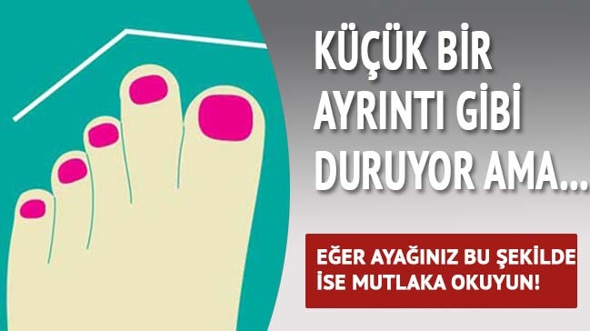 Ayak Parmaklarına Göre Karakter Analizi galerisi resim 1