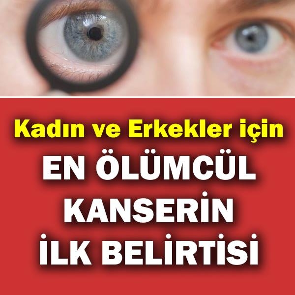 Uzmanlar açıkladı.. Bu belirtilerden birisi sizde de varsa hemen doktora galerisi resim 1