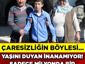 20 Yaşındaki Genç Günden Güne Eriyor!