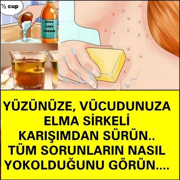 YÜZÜNÜZE, VÜCUDUNUZA ELMA SİRKELİ KARIŞIMDAN SÜRÜN… TÜM SORUNLARIN NASIL galerisi resim 1