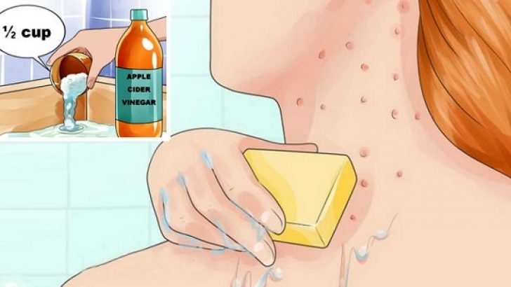 YÜZÜNÜZE, VÜCUDUNUZA ELMA SİRKELİ KARIŞIMDAN SÜRÜN… TÜM SORUNLARIN NASIL galerisi resim 5