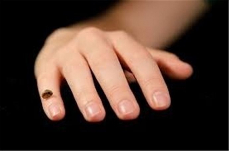 Tırnak Şekline Göre İnsan Kişiliği galerisi resim 3