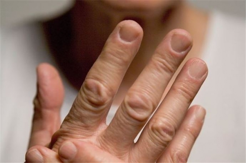 Tırnak Şekline Göre İnsan Kişiliği galerisi resim 5