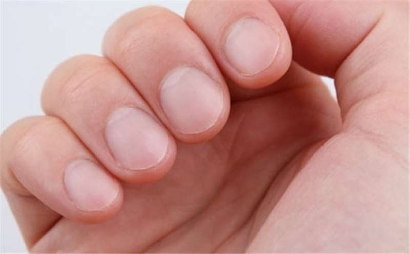 Tırnak Şekline Göre İnsan Kişiliği galerisi resim 6