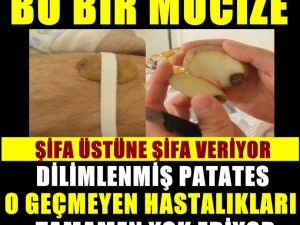 Dilimlenmiş çiğ patatesin bilinmeyen şaşırtıcı faydası...!