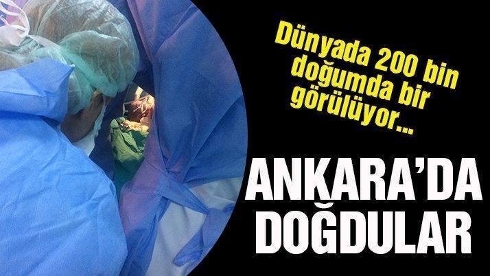 TÜRKİYE'NİN KANINI DONDURAN HABER DOKTORLAR GÖZLERİNE İNANAMADI galerisi resim 2