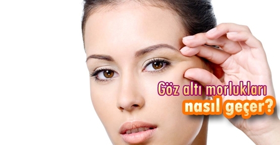 Göz Altı Morlukları İçin Kahve Maskesi galerisi resim 8