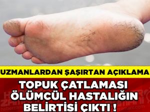 AMAN DİKKAT EDİN!