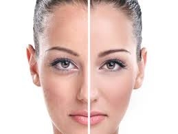 CİLDİNİZİ 3 GÜNDE BEYAZLATIN.. İŞTE O YÖNTEM !! LİMON İLE….. galerisi resim 5