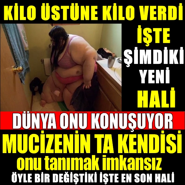 İNANILMAZ HİKAYESİ UMUT OLDU... . KİLO ÜSTÜNE KİLO VERDİ... ÖYLE BİR ZAY galerisi resim 1