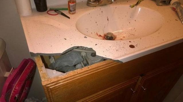 ELEKTRONİK SİGARA YÜZÜNDE PATLADI !!! galerisi resim 4