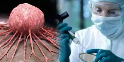 DOKTORLARIN ASLA SÖYLEMEYECEĞİ, KANSERİN ARDINDAKİ GİZLİ GERÇEK! galerisi resim 2