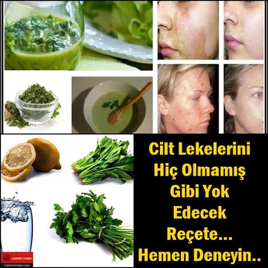 Cilt Lekelerini Hiç Olmamış Gibi Yok Edecek Reçete… Hemen Deneyin.. galerisi resim 2