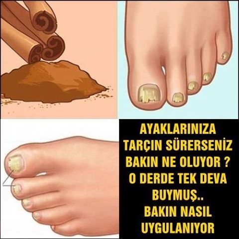 AYAKLARINIZA TARÇIN SÜRERSENİZ BAKIN NE OLUYOR ? O DERDE TEK DEVA BUYMUŞ galerisi resim 1